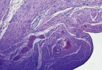 Untargeted Spatial Metabolomics